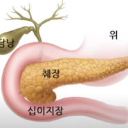 인슐린 저항성을 알면, 당뇨, 고혈압, 고지혈증 약 끊을 수 있습니다! 혈관 건강 전문병원 나은길외과