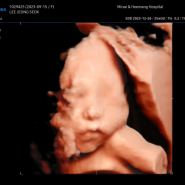 9월 임신 + 일상 기록 (임신 24~27주) : 입체초음파, 임당검사