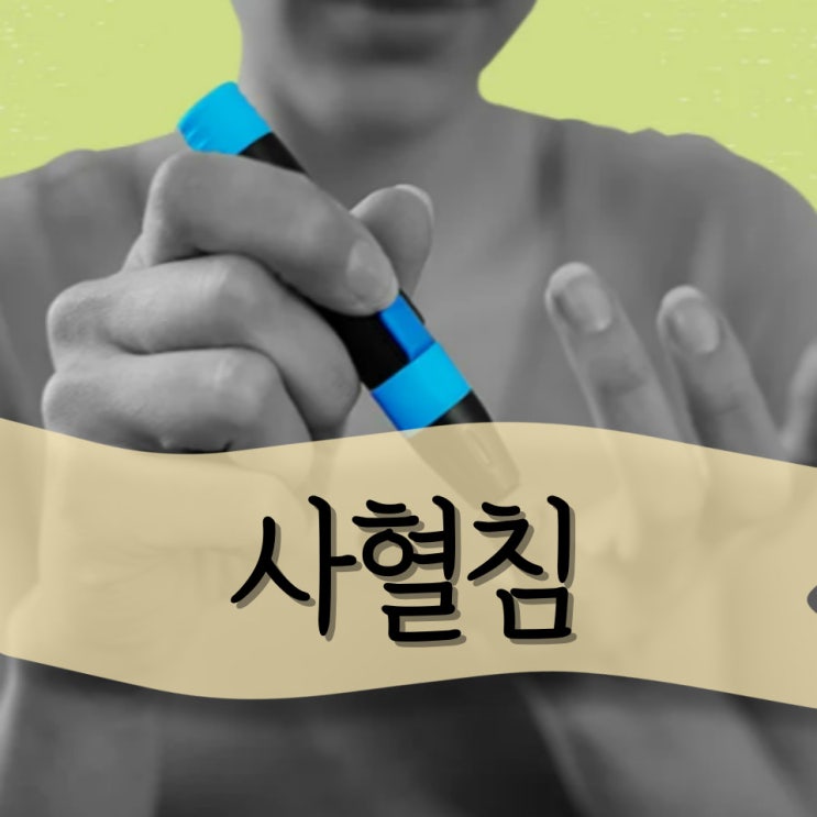 사혈침, 손따는침 : 체했을때 손따는법 알아두세요 : 네이버 블로그