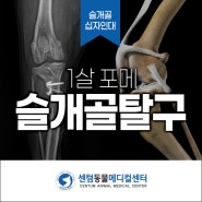 부산 포메라니안 슬개골탈구 수술 후기 - 센텀동물메디컬센터