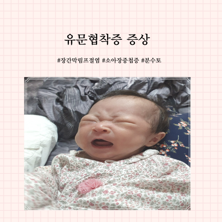 유문협착증 증상 신생아분수토 아기구토 소아장중첩증 장간막림프절염 : 네이버 블로그