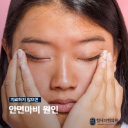 안면마비 원인 알고 치료하지 않으면