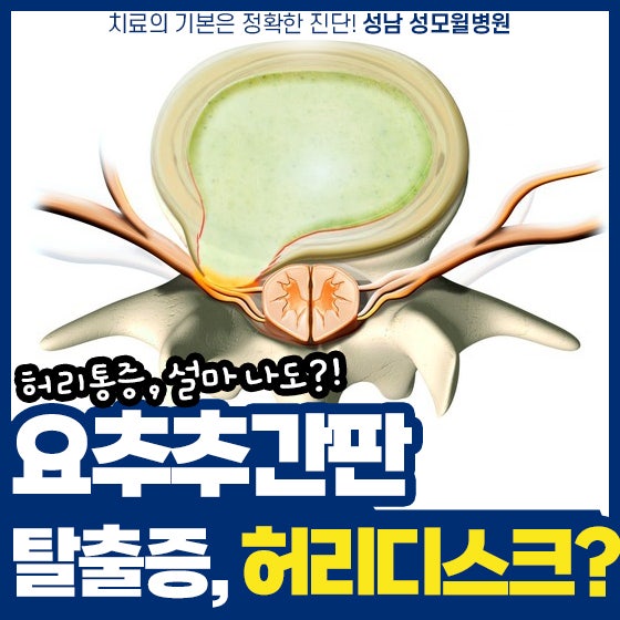위례척추병원 요추 추간판 탈출증 진단과 치료 : 네이버 블로그