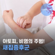 아토피, 비염의 주범은 바로 새집증후군