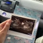 [5주차] 산부인과 첫 진료/임신확인서/산모수첩/국민행복카드