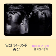 임신기록 34주-36주 임신 10개월, 출산휴가, 막달검사, 불면증, 손가락 마디통증