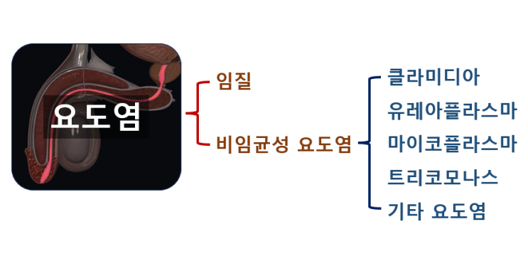 임질, 비임균성 요도염 : 네이버 블로그