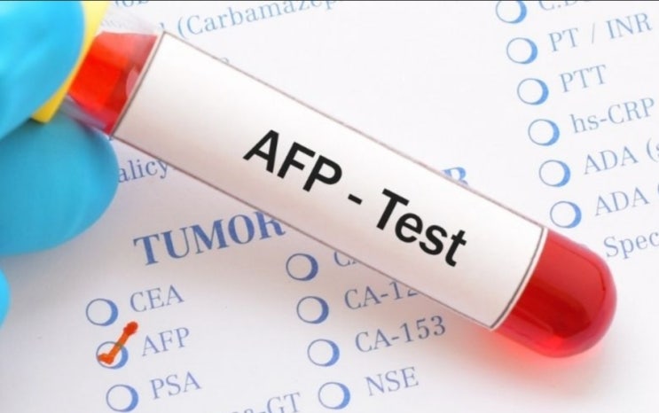 AFP 수치가 높으면 간암 종양표지자 검사 afp 수치 낮추는 방법 : 네이버 블로그