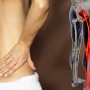 허리통증 및 다리저림 : 신경 가동술의 강력한 효과