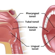 ENT OP 1탄, Tonsilectomy(편도절제술)