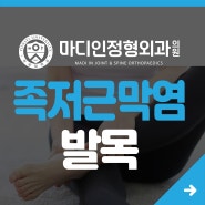 발목 질환과 스트레칭 - 족저근막염 예방하기