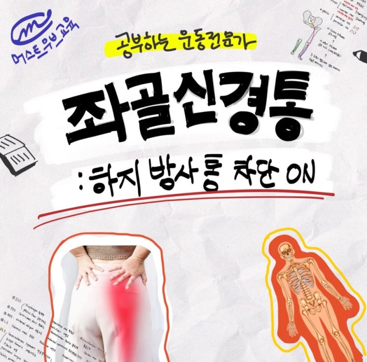 좌골신경통 증상 좌골신경통 스트레칭 : 네이버 블로그