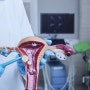 자궁적출수술 후유증과 부작용을 예방하는 자궁적출 후 관리(복강경)