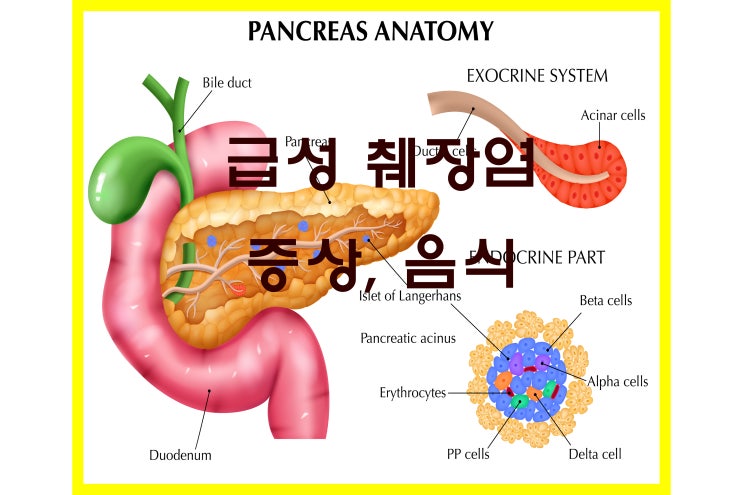 급성 췌장염 원인과 증상 및 음식 주의사항은? : 네이버 블로그