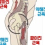 불균형의 원인 중 하나! 전방경사