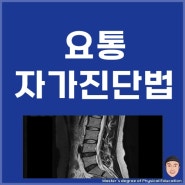 요통 검사 방법(허리 통증 자가 진단)