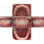 신길동치과 환한 웃음을 위한 치아교정