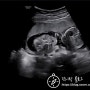 [임신, 출산 기록] 임신 18주~21주차