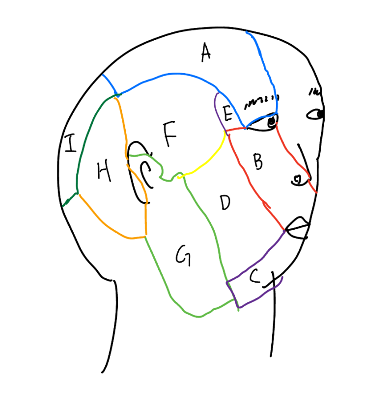 1-2. 두통 / 이개측두신경 포착 (auriculotemporal nerve entrapmnet) / 관자놀이 쪽의 두통 ...