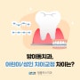 방이동치과, 어린이 / 성인 치아교정 차이는?