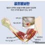 광주 북구 필라테스에서 '골프엘보'통증 부터 예방까지 알아보아요