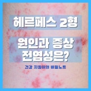 여자 성병 헤르페스 2형 원인과 증상 전염 알아보기