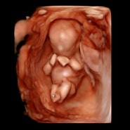 [임신일기] 임신 12-15주차 증상 기록✏ | 첫 입체초음파 | 1차 기형아검사 | 각도법 성공 | 임신성여드름 최고치 | 입덧완화 | 성별 확정