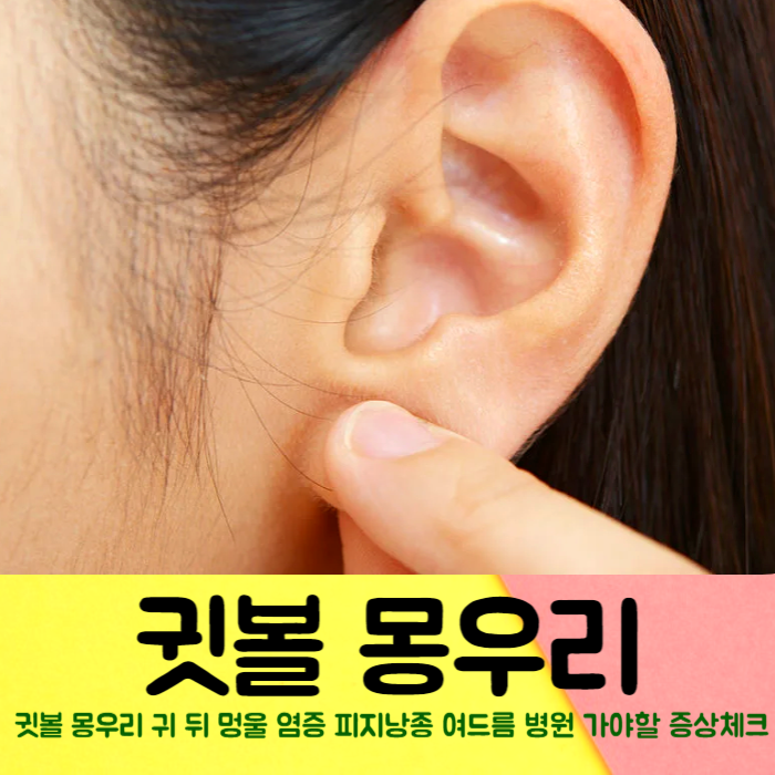 귓볼 몽우리 귀 뒤 멍울 염증 피지낭종 여드름 병원 가야할 증상 체크 리스트 : 네이버 블로그