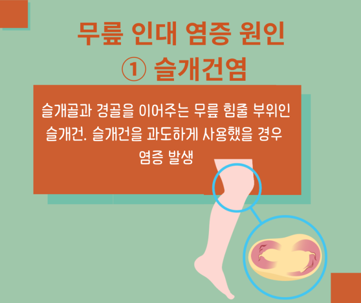 무릎 인대 염증 원인은? 염증 통증 관리 위한 이것 : 네이버 블로그