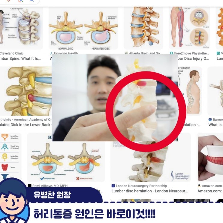낙성대역정형외과, 환자에겐 말하지않는 주사치료의 비밀을 공개합니다. : 네이버 블로그