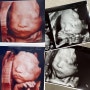 낭만 임신기록 25주~27주 : 26주 입체초음파, 임당검사, 태교여행