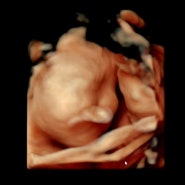 임신중기, 성별확인-태동-등트러블-몸무게-손발붓기