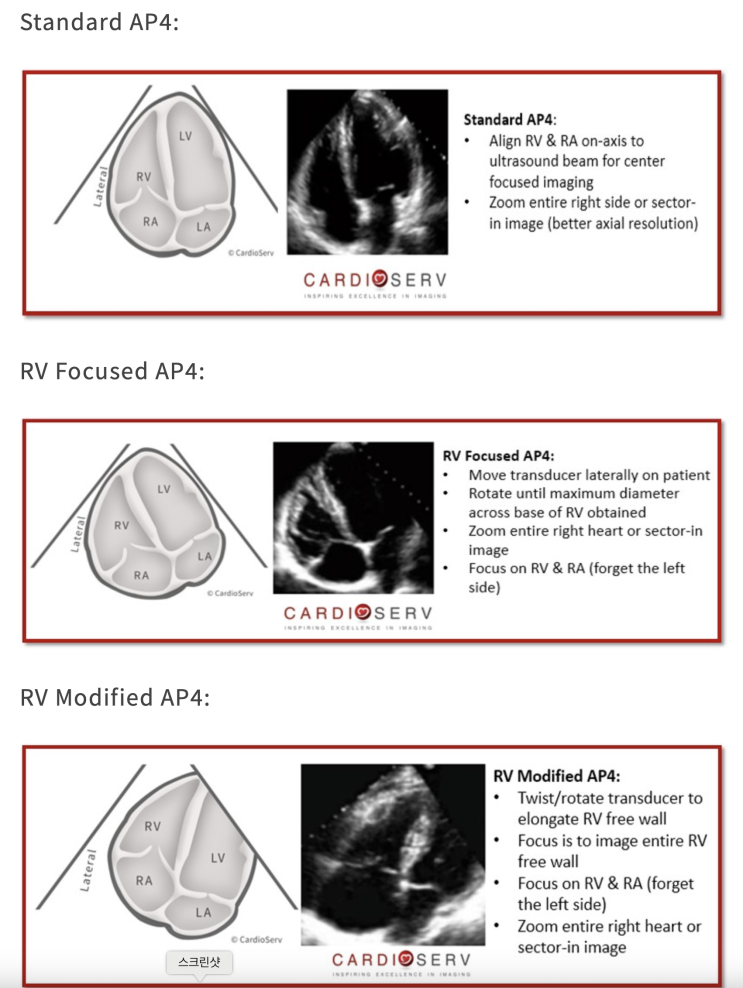 RV focused AP4 view, RV modified AP4 view : 네이버 블로그