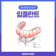 하남시임플란트 미사리더스치과의원 무치악 임플란트 정의와 장점, 치료 방법은?