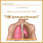 [ICU에서 공부하다] 기흉에 관한 이론편•기흉(pneumothorax)