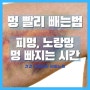 멍 빨리 빼는법, 피멍 노랑멍 빼는법, 멍 빠지는시간