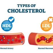 HDL 콜레스테롤 수치: 동맥 경화, 심혈관 질환, 혈액 검사, 지단백질