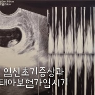 [임신초기증상]과 임신출산 필수품 [태아보험 가입시기]