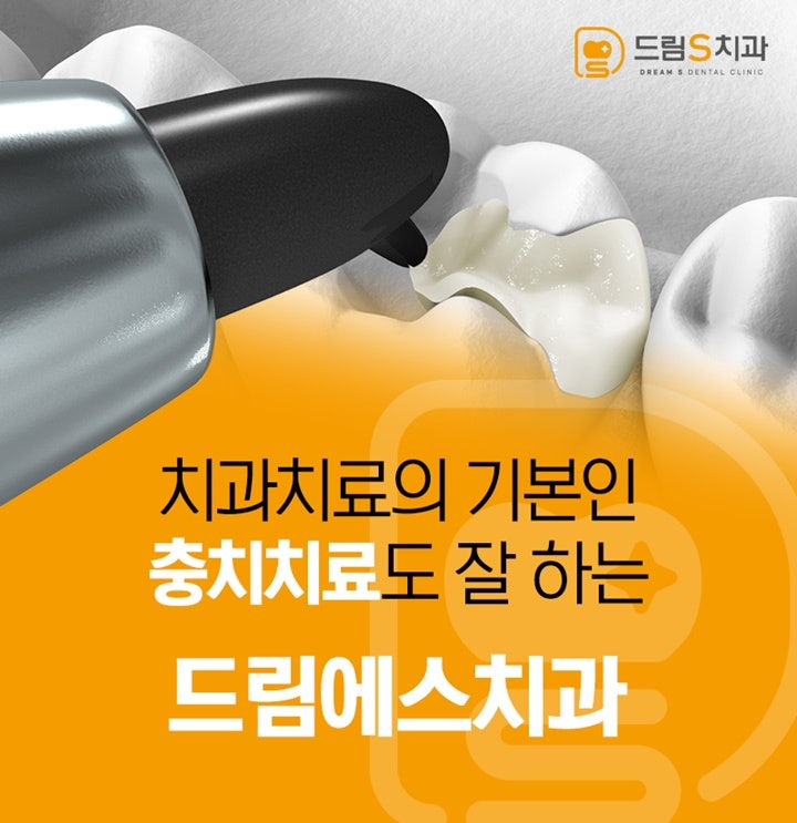 발치 전에 치아를 먼저 살리기 : 네이버 블로그
