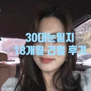 [눈밑지후기4탄]어언 1년 넘어 18개월 후기, 눈밑지 풀스토리::30대 눈밑지방재배치 후기