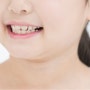 한창 성장기를 지나는 소아(어린이), 치아교정 점검의 적절한 시기