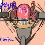 자궁선근증수술 다른 방법 없다고 할 때