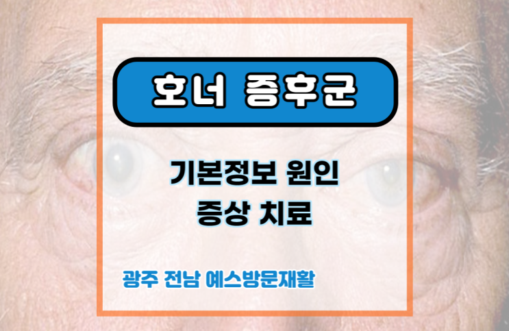 호너 증후군 신드롬 (Horner's syndrome) 기본정보, 암, 원인, 증상, 치료 정보. : 네이버 블로그