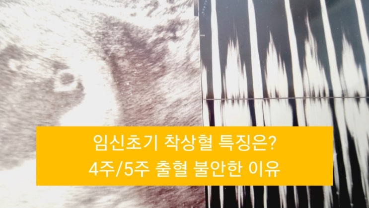 임신초기 착상혈 임신 4주 5주 불안했던 출혈 : 네이버 블로그