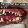 [대구동물병원][외과특화동물병원][수성구동물병원][응급진료][스케일링] 개 신경치료(근관치료, Root canal therapy) 및 크라운 치료