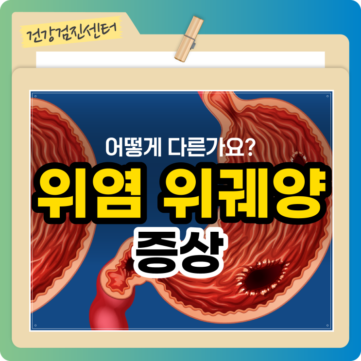위염 증상과 위궤양 증상은 어떻게 다른가요? : 네이버 블로그