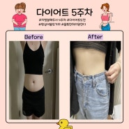 대전지방분해주사 복부다이어트 잘록한 허리 대만족(후기)