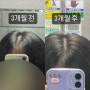 탈모샴푸 3개월간의 노력 제로시피 샴푸 feat. 3개월간 노력 썰 광고 X)