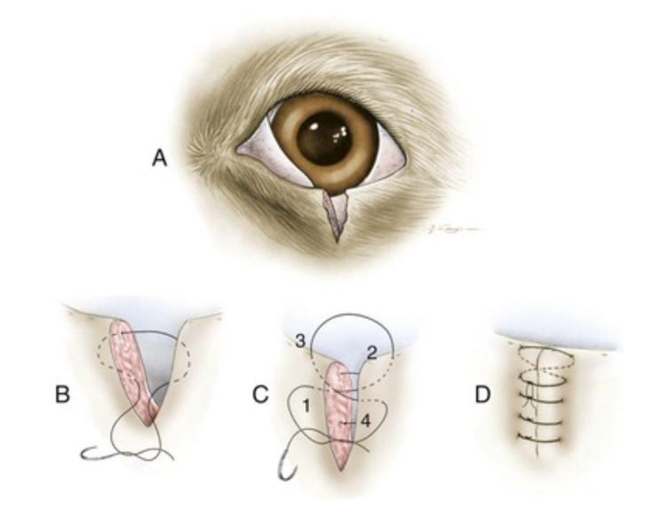안검 mass 의 제거: Two-layer closure used to appose the eyelid margin : 네이버 블로그