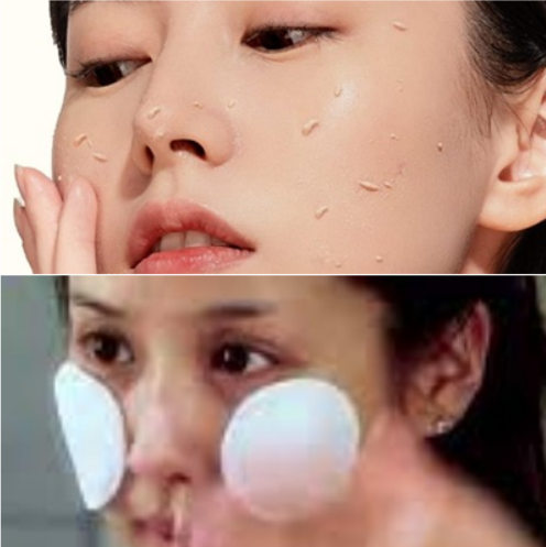 쌀쌀한 겨울 피부 타입별 각질 제거 방법(지성, 건성) : 네이버 블로그